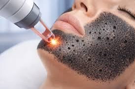 Carbon Glow Kezelés