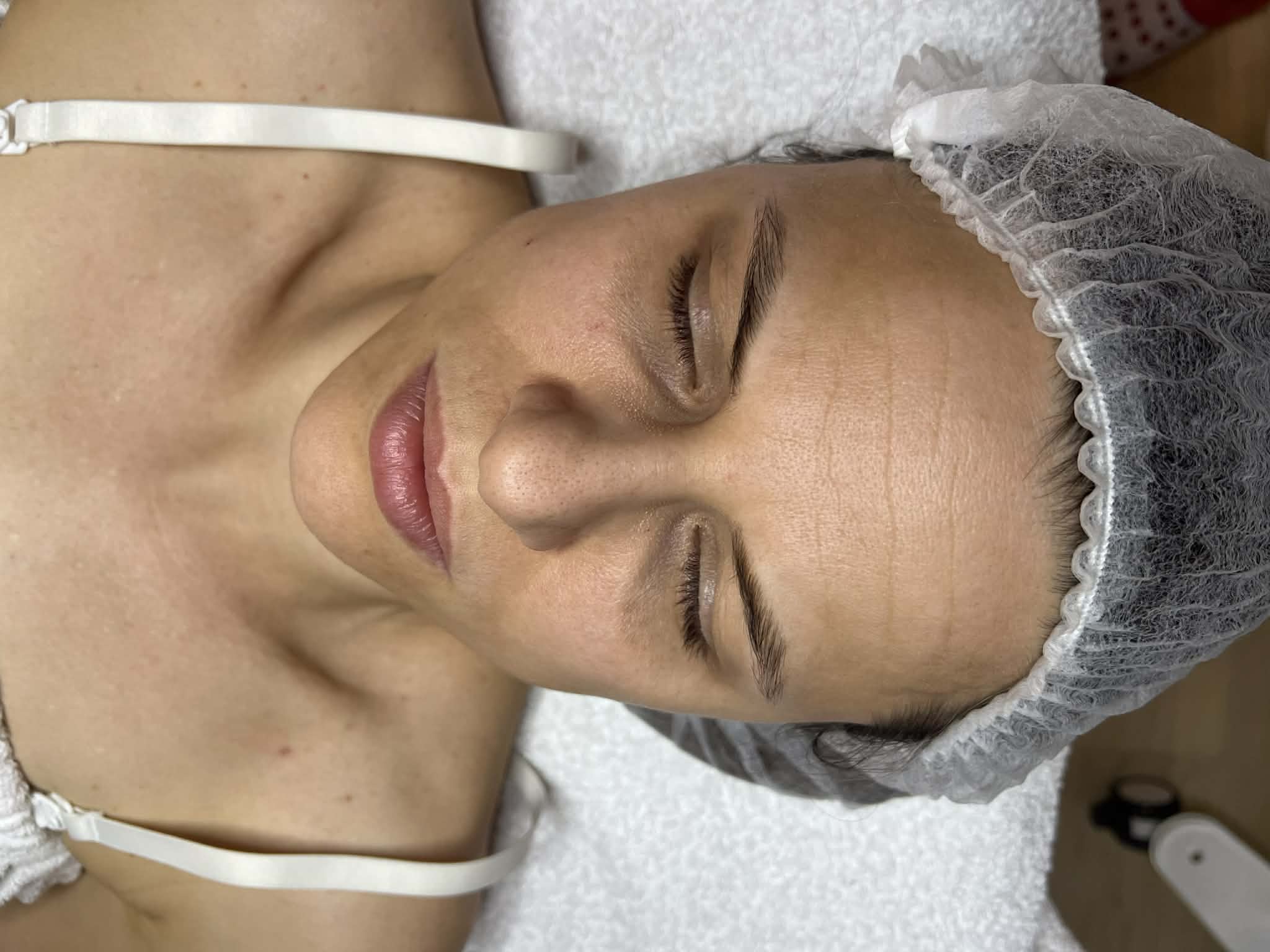 Elektroporációs Kezelés Előtt