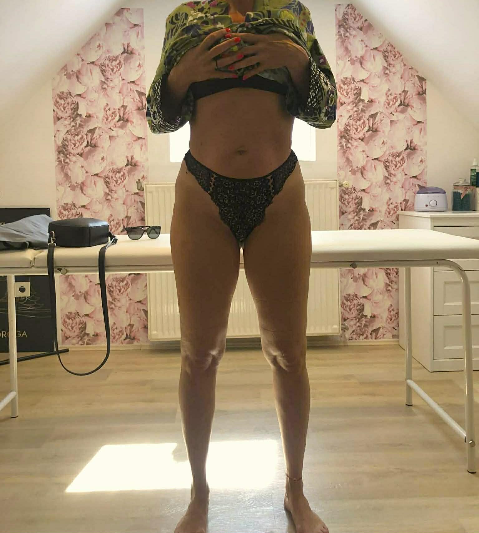 Hiemt Kezelés Után