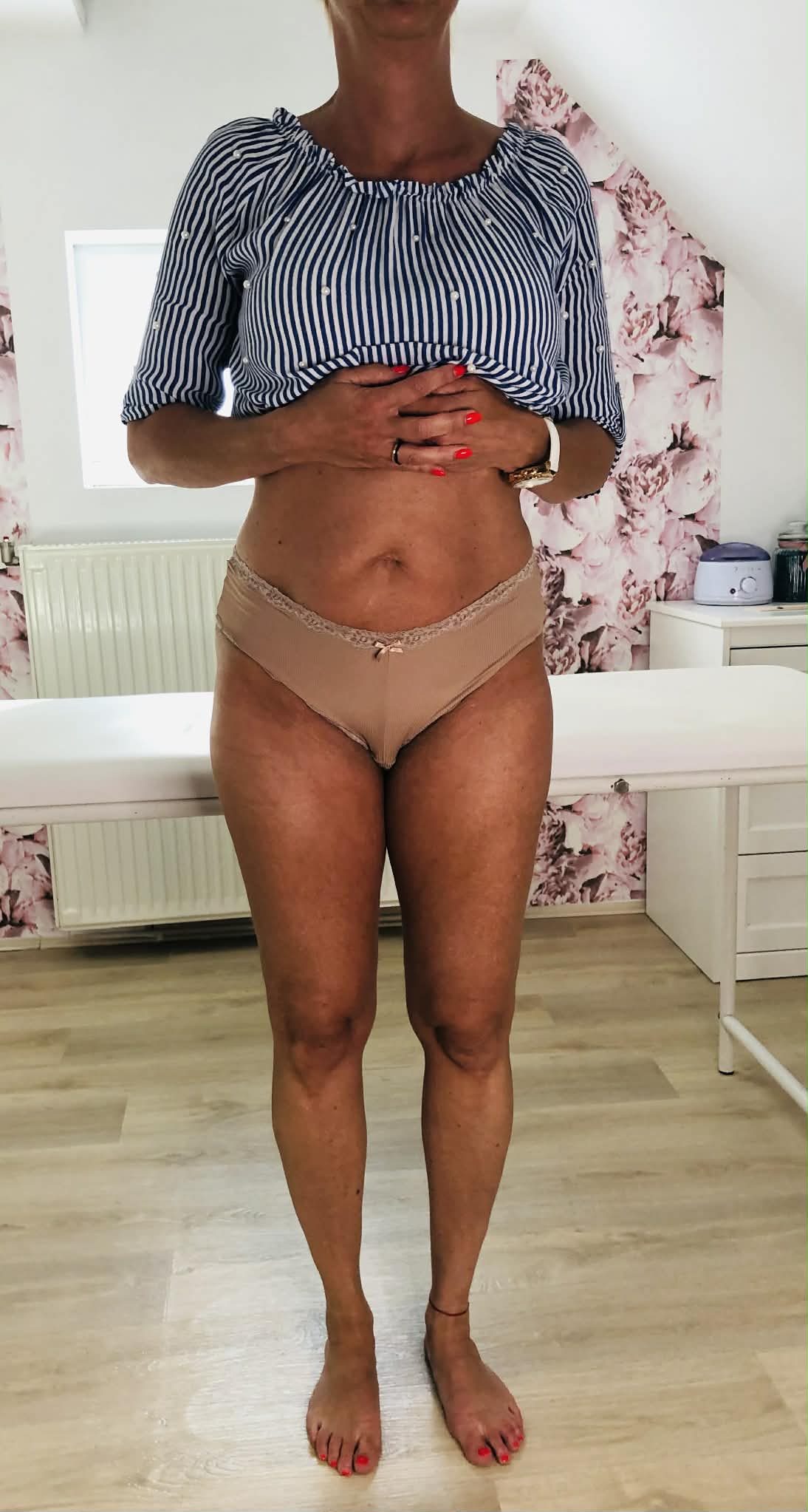 Hiemt Kezelés Előtt