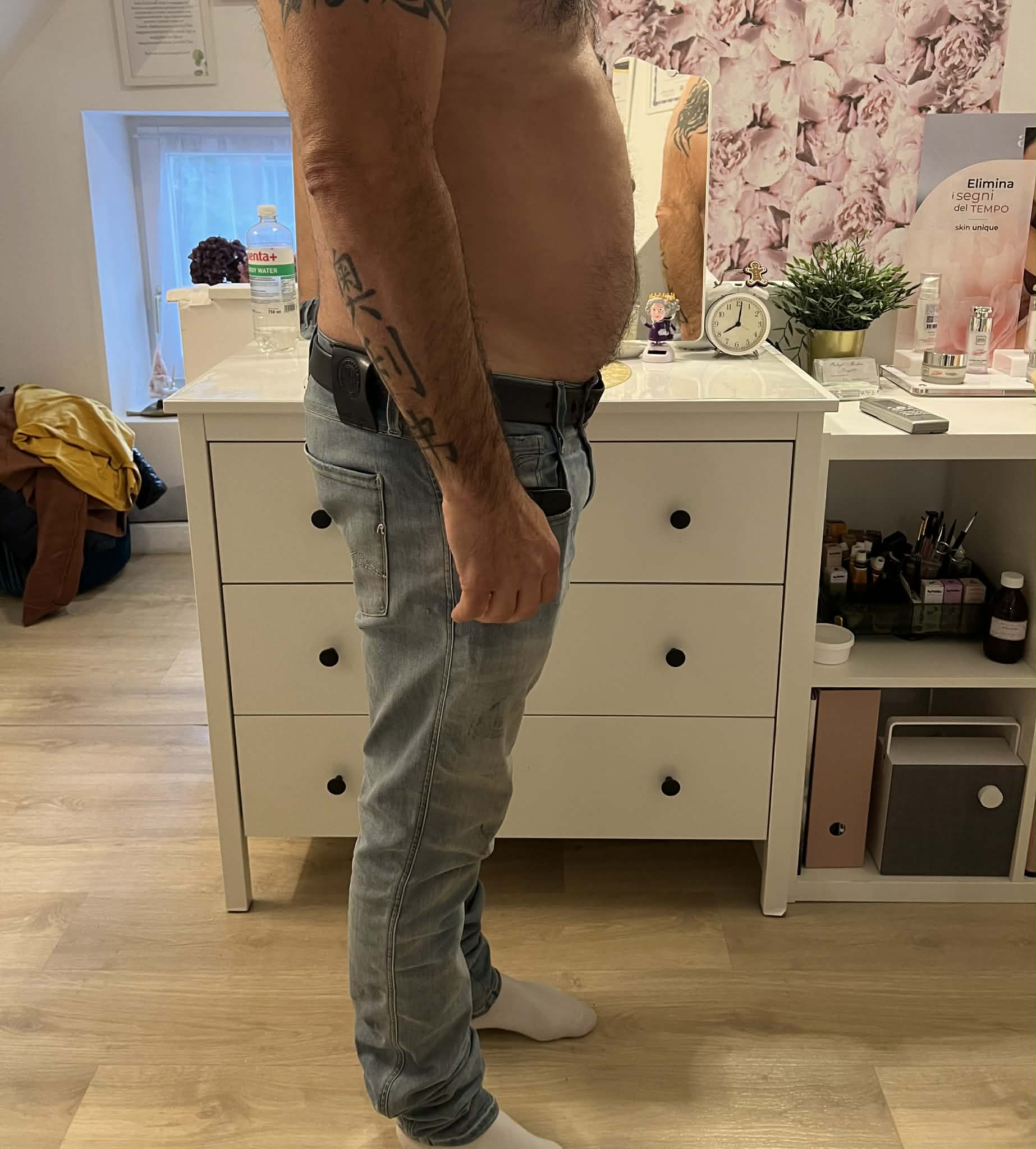 Lipolézer Kezelés Előtt