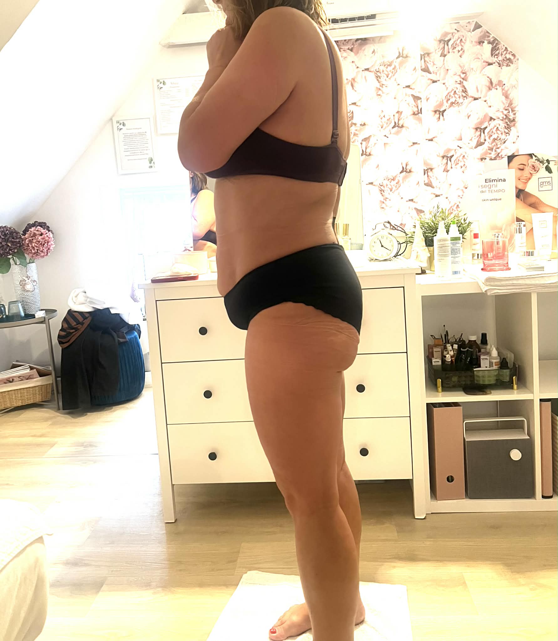 Wiener Kezelés Után