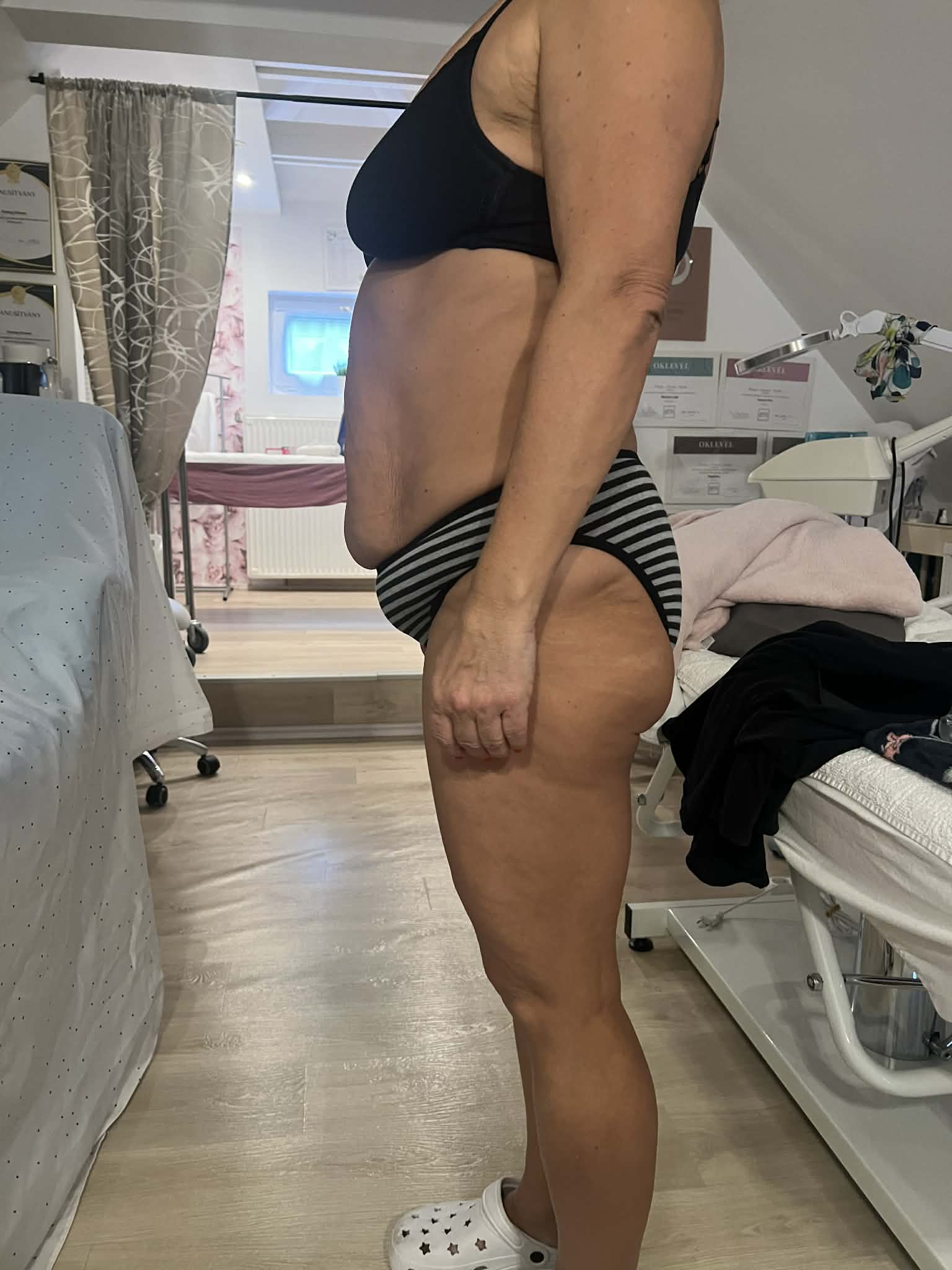 Wiener Kezelés Előtt